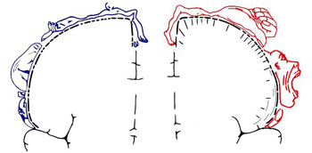 Figure 10 : Représentation stylisée (dite de Penfield) des homoncules humains, sensoriel à gauche, moteur à droite.