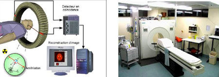 Figure 11 : Tomographie à paires électron-positron.