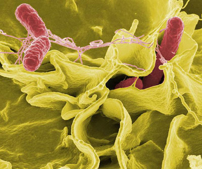 Figure 5 : Salmonella typhimurium (en rose) sur une culture de cellules humaines (image Wikimedia Commons – origine NIH). Cette bactérie provenant des rongeurs se transmet à l’homme par ingestion d’eaux usées. C’est un des nombreux agents des entérites à salmonelles.