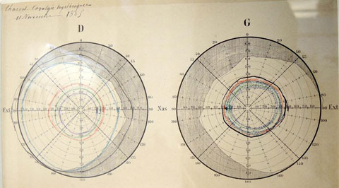 Figure 11 : Le tableau analytique des phénomènes qui peuvent être observés, réalisé en novembre 1885 à partir d’examens et mesures prises par l’équipe de Charcot : pouls, températures, volumes, données biologiques….. (© Musée de l’AP-HP/ Photo : HCS)